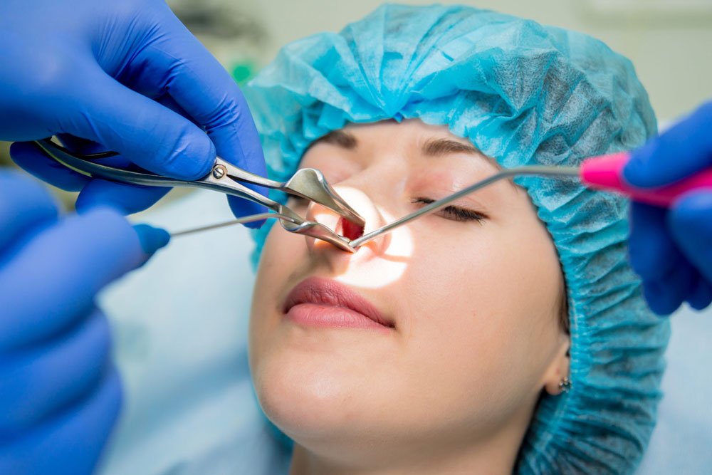 Nasal Surgeries
